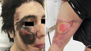 La cara, las manos y