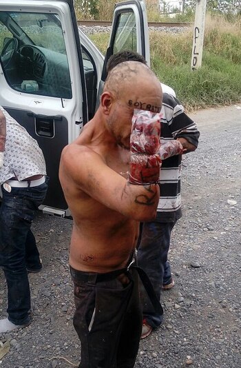 Los mutilados tenían sus heridas