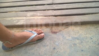 El punto donde Marcelo “Conejo” Rey golpeó su cabeza y sufrió la herida mortal