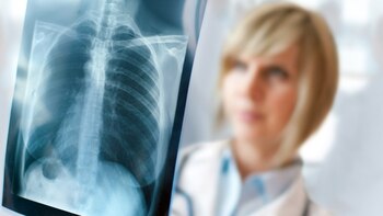 También son vulnerables los adultos mayores de 65 años y pacientes que presentan ciertas enfermedades como diabetes, enfermedades cardíacas, pulmonares (EPOC) o renales crónicas y pacientes inmunocomprometidos (IStock)