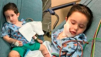 El niño de dos años fue hospitalizado con profundas heridas en el rostro y una pierna