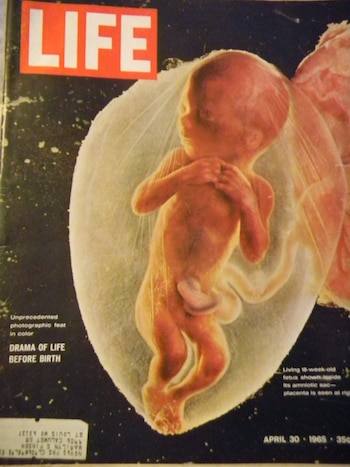 Foto de sueco Lennart Nilsson. El número vendió 8 millones de copias, que se agotaron en 4 días. Era la primera vez que se mostraba un feto y la imagen contribuyó a que se hablara del aborto. 30 de abril de 1965. La revista Time la eligió como una de las 100 fotos más influyentes de la historia(Lennart Nilsson/LIFE Magazine)