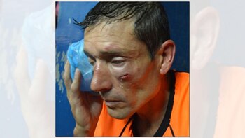 Claudio Elichiri fue brutalmente agredido