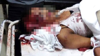 El cuerpo sin vida de