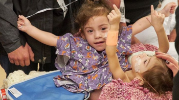 Dos pequeñas siamesas fueron separadas