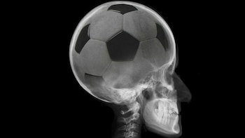 El cerebro de los futbolistas