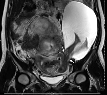 La imagen captada por el