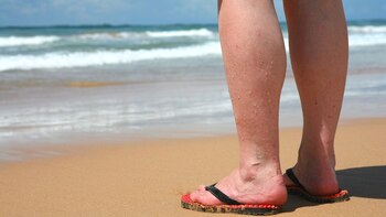 Esta patología es mucho más