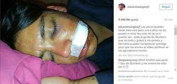 Imagen F3IO4SNXNVGJZFEZNHXGJSPRQM