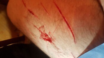 Así quedó el brazo de