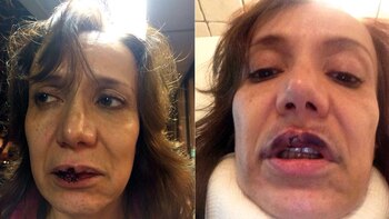 reri, con las secuelas de