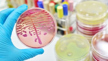 Esta bacteria intestinal se trasmite