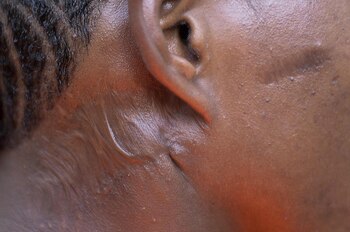 Un guerrillero muestra su herida