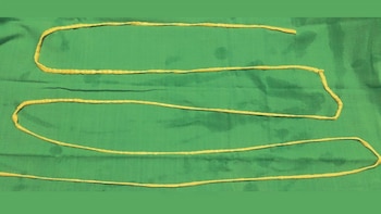 La tenia retirada al paciente