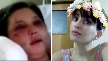 Belén Torres, antes y después del ataque