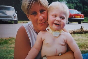 Jessi tenía una traqueotomía cuando