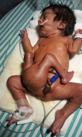 El niño “sin nombre”, cuya