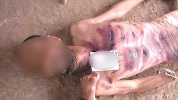 Los cadáveres esqueléticos se apilan