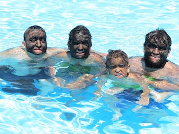 El Síndrome del Hombre Lobo