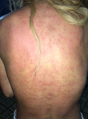 La espalda de la surfista