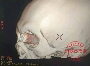 La tomografía que se le