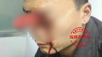 El joven declaró que su