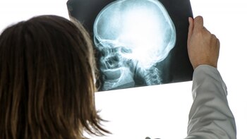 En los jóvenes la principal