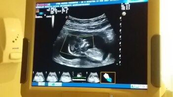 El futuro “nieto” de del