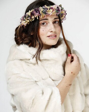 Alba Parejo sufre de una