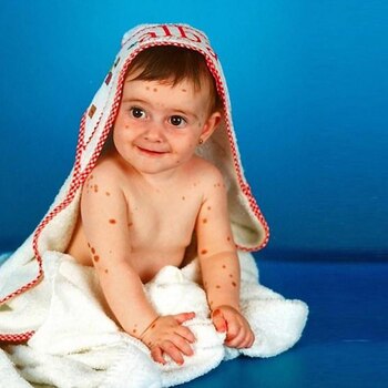 Alba con meses de vida