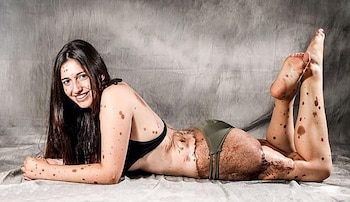 No existen cifras oficiales de