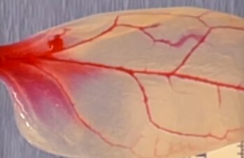 Aunque tienen abordajes muy diferentes,