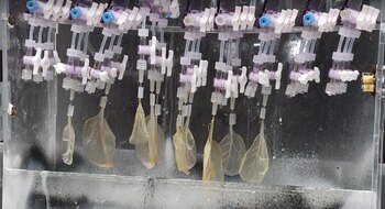 Las hojas de espinaca pueden