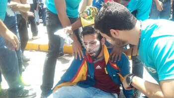 Un manifestante herido por la represión de la policía chavista (@VenteVenezuela)
