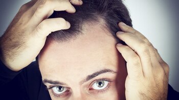 Un cuero cabelludo poco hidratado