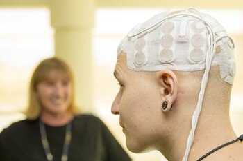 Optune no tiene efectos secundarios