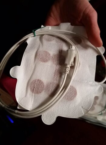 Un tratamiento con electrodos que