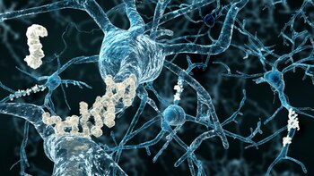 Esta unidad generalmente comienza a