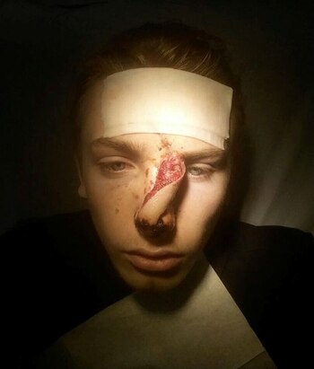 Así llegó Noel al hospital