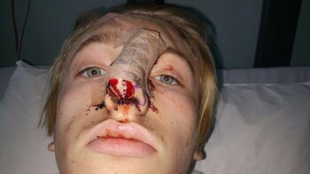 Durante ocho meses deberá someterse