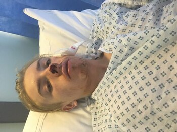 Aiden Noel se recupera en