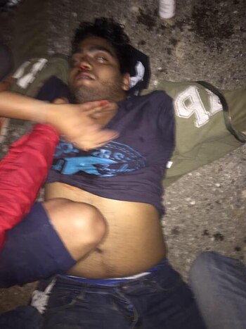 Jairo Ortiz tras el balazo,