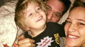 Luego de la extirpación del