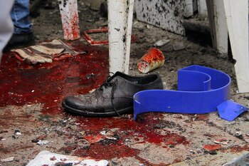 Restos de una víctima en