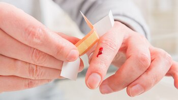 La hemofilia A es el