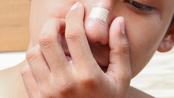 Operación quirúrgica para restaurar la