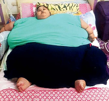 Eman Ahmed llegó a pesar