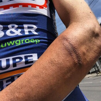 Yoann Offredo sufrió golpes en