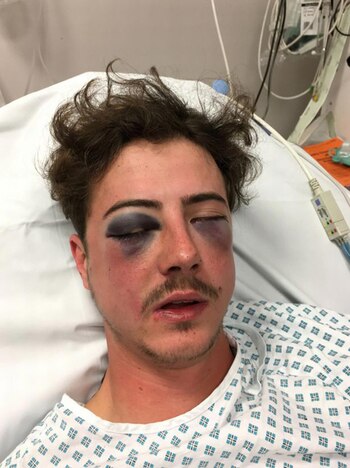 Voller podría tener problemas irreversibles