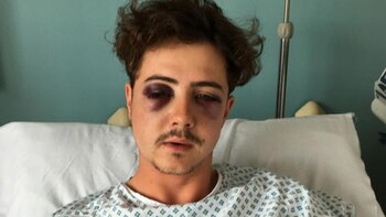 Así quedó el rostro de